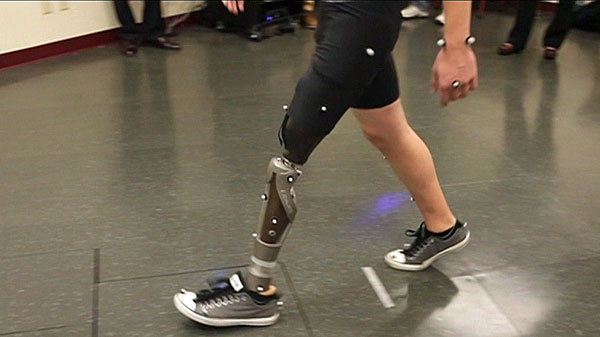 Permanent Prosthetic Could Change Lives For Amputees | King5.com