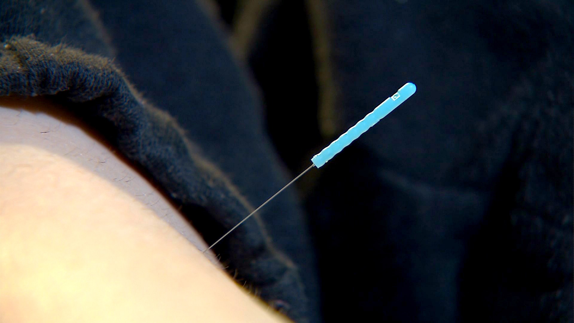 Needles don't hurt a bit at Seattle Children's