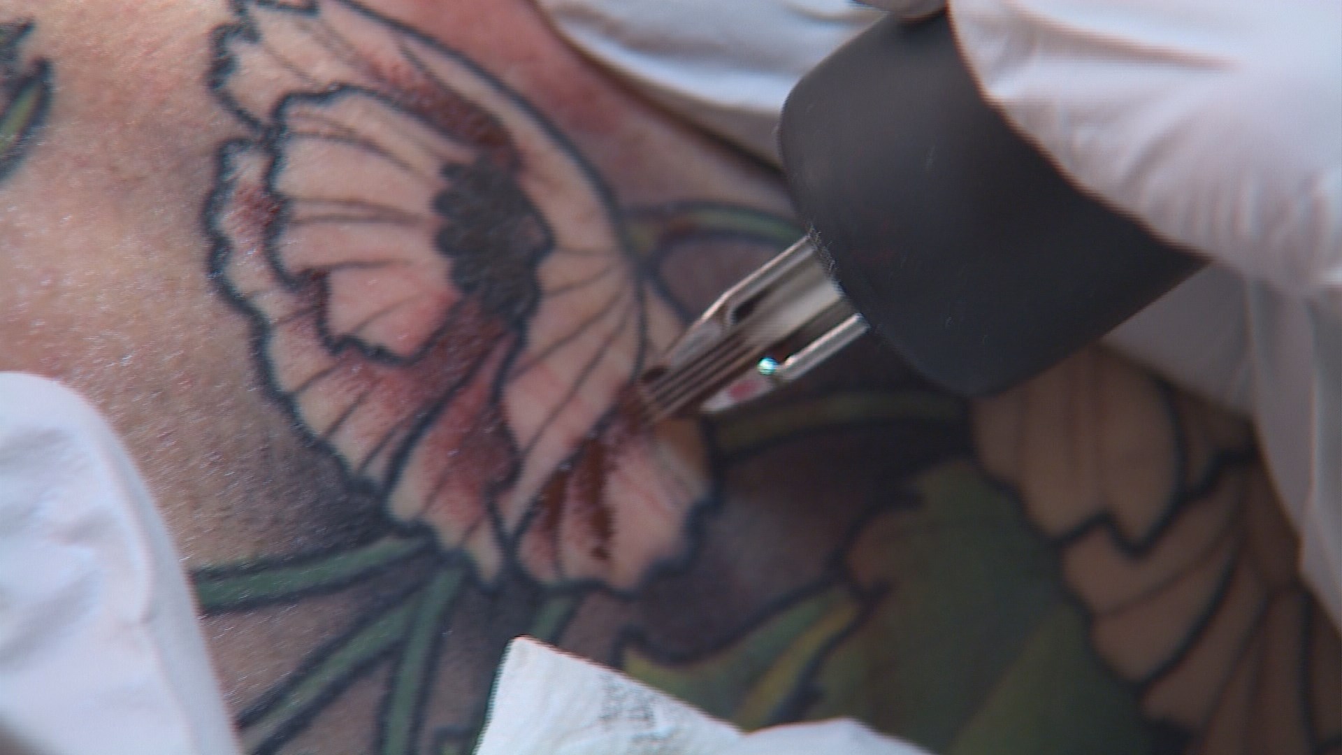 Restorative 3D tattoos help cancer survivors 